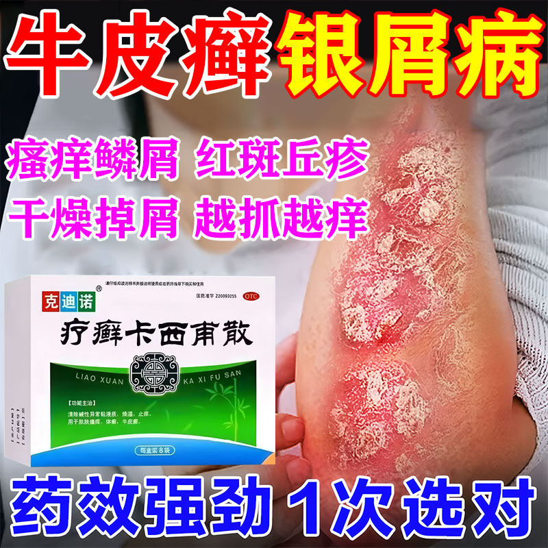 【兆誉隆】疗癣卡西甫散10g*8袋/盒