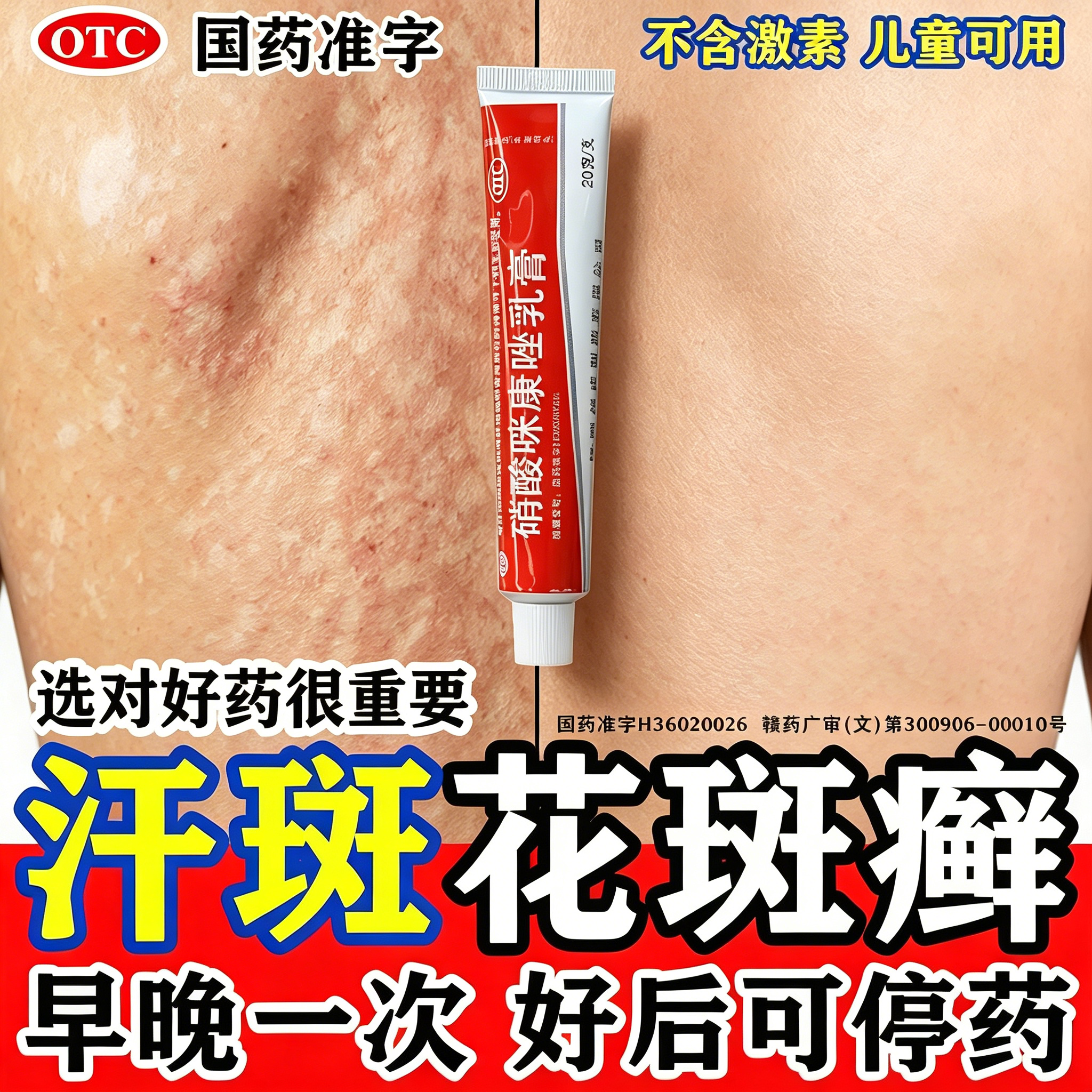 [扬子洲]硝酸咪康唑乳膏2%*20g*1支/盒