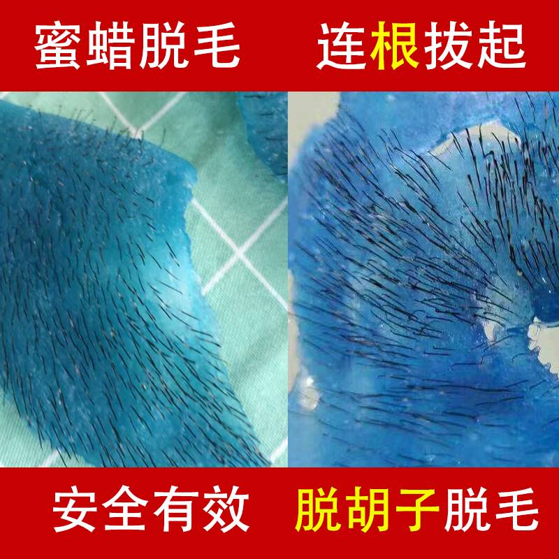 蜜蜡除毛拔胡子神器拔胡须u腋下唇毛拔起去面部汗毛胡渣男士除毛