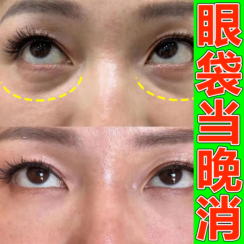 眼部精油抗皱紧致去眼袋药膏祛除神器男士专用眼霜去黑眼圈袋克星