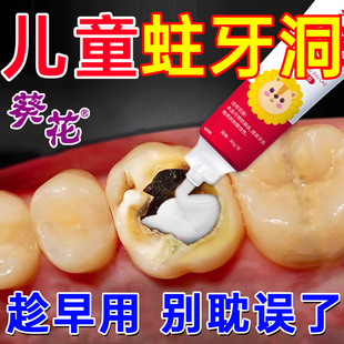 儿童牙膏防蛀牙龋齿修复去黑线儿童牙膏6到12岁含氟 换牙期自补UU