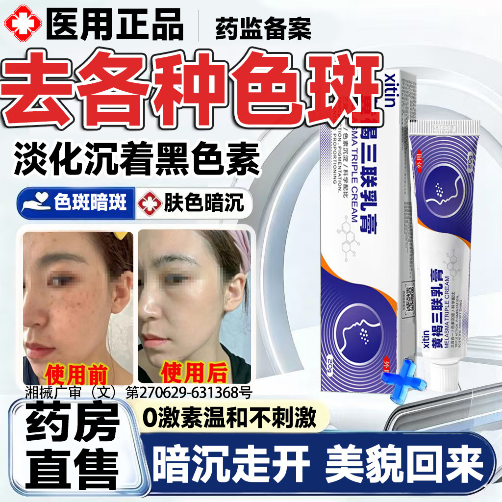 祛斑三联乳膏官方旗舰店医用级正品祛黄褐斑老分解黑色素黄雀斑LT图片