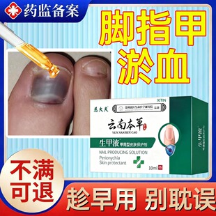 脚趾甲被砸专用指甲被夹压受损坏死甲下有淤血变发黑止痛修复液WY
