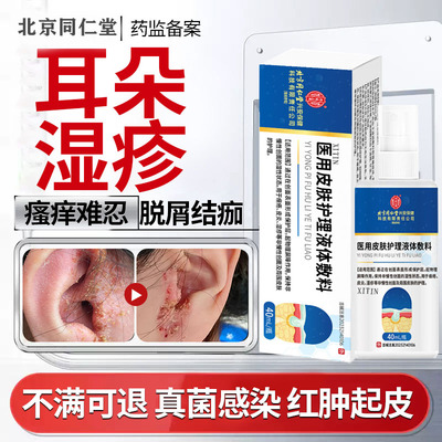 【北京同仁堂】耳朵湿疹真菌感染