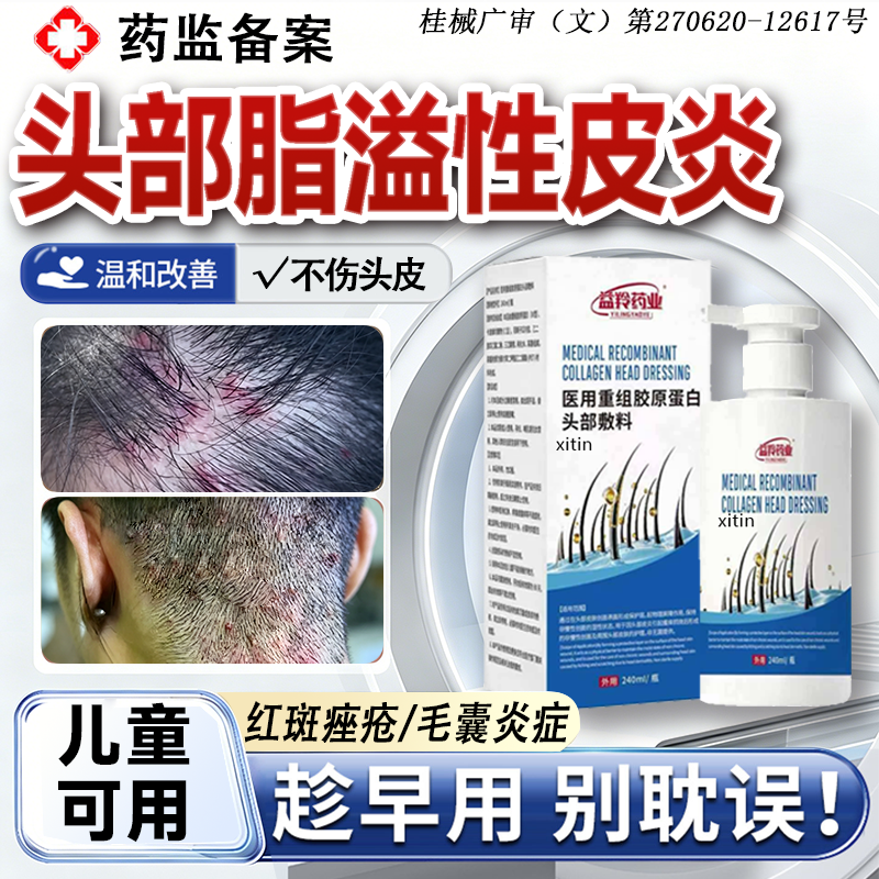 脂溢性皮炎头部喷剂头痒有疙瘩痤疮真菌感染毛囊炎头皮屑止痒癣WK
