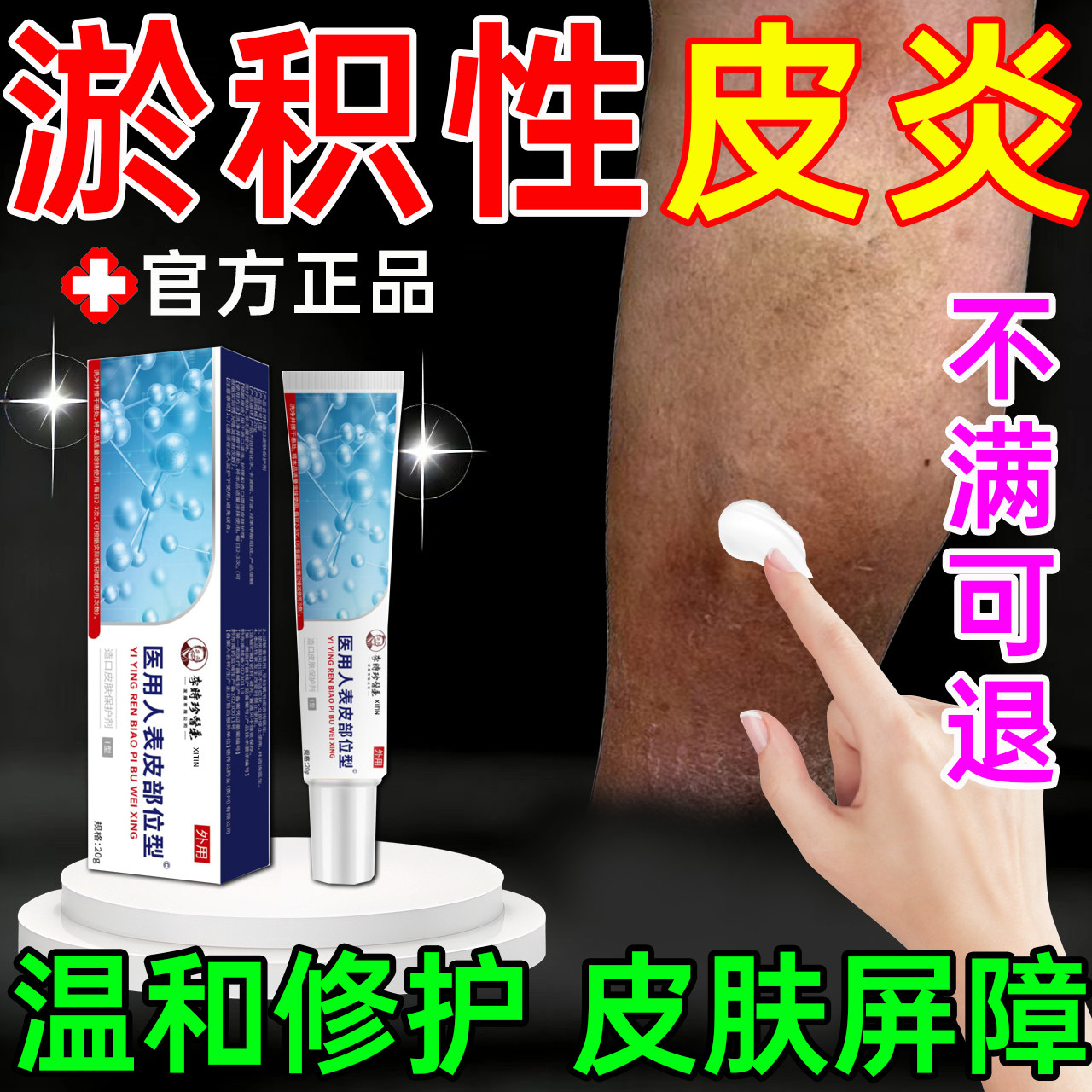 淤积性皮炎小腿发黑发紫瘙痒红肿静脉曲张静脉炎湿疹专用修复膏PP