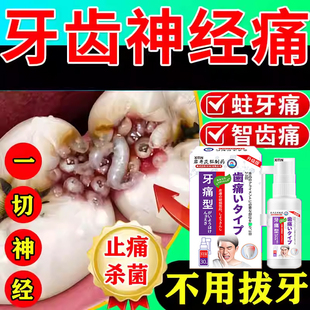 牙齿神经痛牙髓炎牙龈脓包肿痛消炎牙疼牙痛牙根上火止疼喷剂ZT