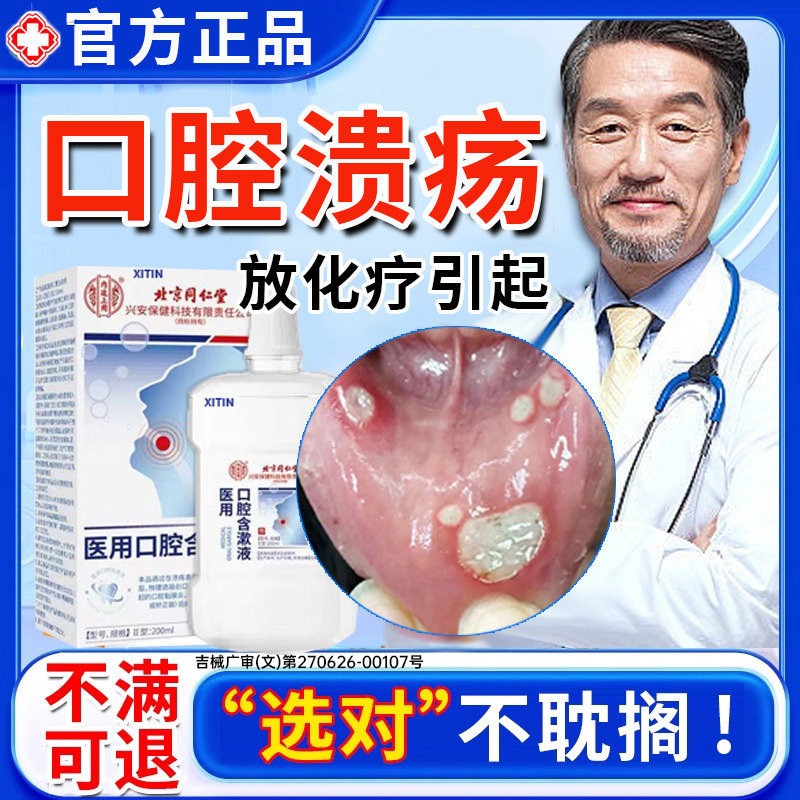 放疗化疗后用口腔溃疡口腔黏膜炎漱口水口舌干生疮疼痛人工唾液UU
