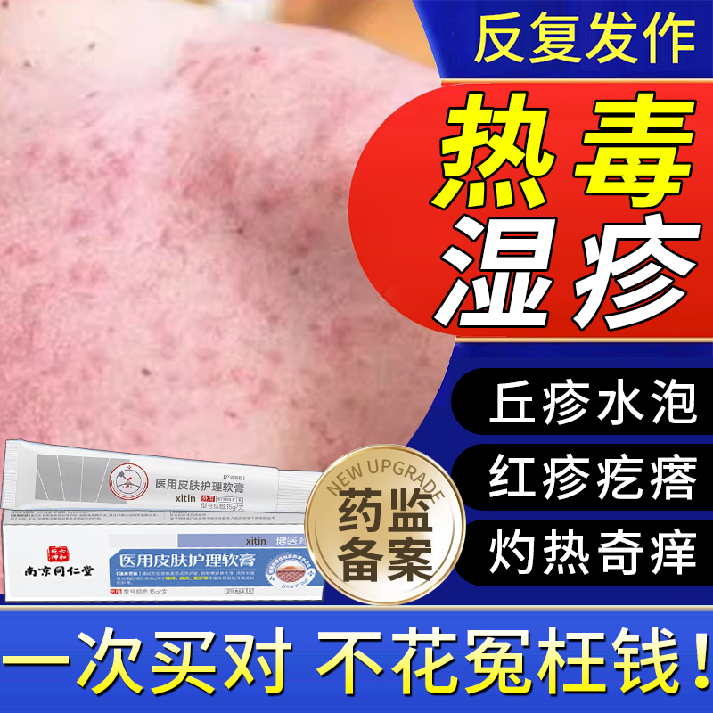 皮肤湿疹止痒去顽固皮炎真菌感染