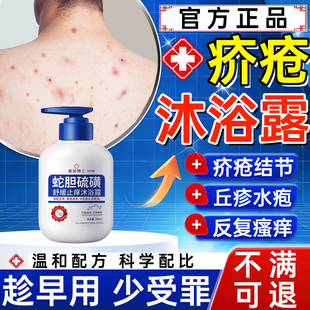 疥疮疥螨结节沐浴露疥虫阴囊喷雾剂皮肤瘙痒红肿疙瘩止痒疥疮膏WY