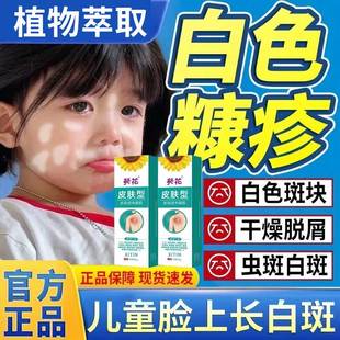 白色糠疹药膏儿童脸上长白斑小孩汗斑专药面部皮肤发红干掉鳞屑ZT
