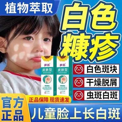 白色糠疹药膏儿童脸上长白斑
