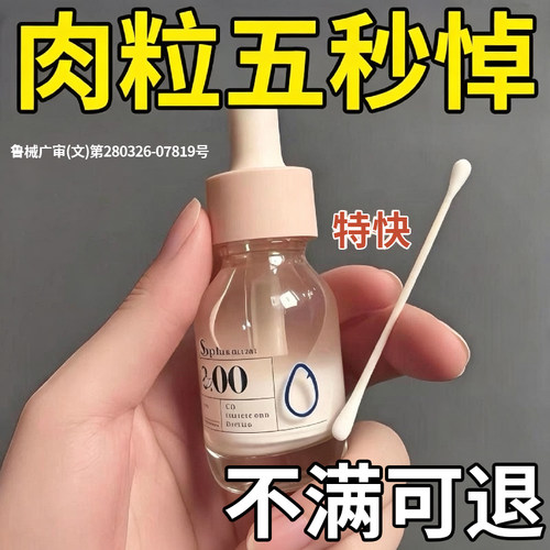 扁平疣专用去除软膏一抹灵去祛疣除根疣瘊小肉粒医用脱落膏神器YB