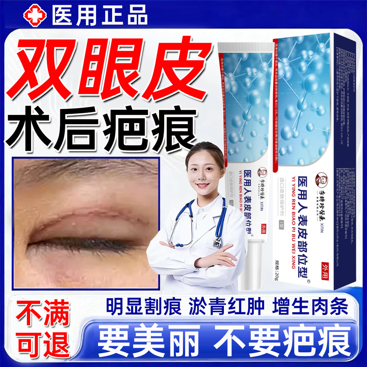 双眼皮术后祛疤膏医用消肿神器开眼角增生凸起手术疤痕去除膏贴UU