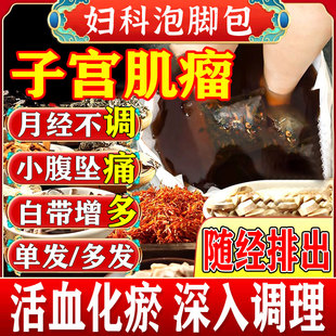 子宫肌瘤泡脚药包中药贴消除热敷女性调理巧克力卵巢囊肿肌腺症GX