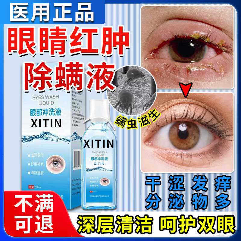 除螨洗眼液眼睛有螨虫眼红干痒痛医用清洁消炎去异物止痒眼药水ZT - 实物图
