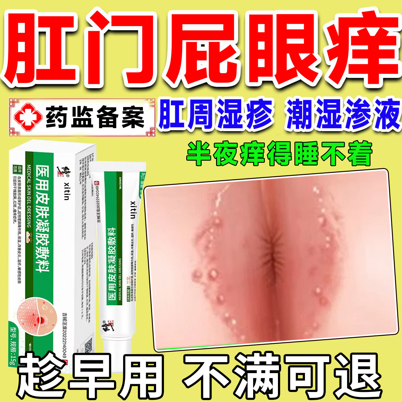 肛周湿疹瘙痒止痒用专膏流特肛周屁眼流根分泌物效男女性医用药LT