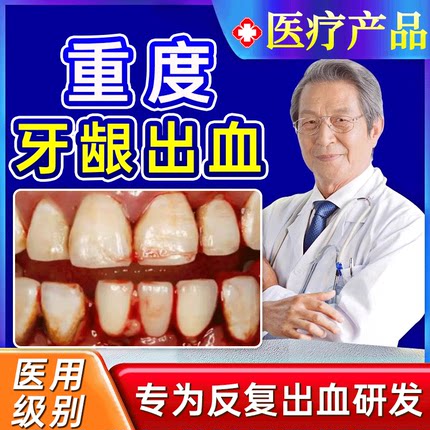 云南白药牙膏牙周炎牙龈出血专用双效抗敏牙龈脓包肿痛消炎药膏gx
