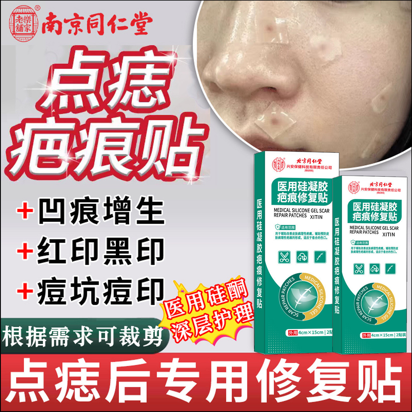 医用激光点痣后疤痕贴去祛痣修复膏硅酮祛疤贴红印凹陷性增生TT
