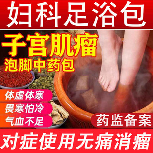 子宫肌瘤泡脚包中药贴卵巢囊肿消茶宫瘤清自己治热敷女性调理疗LL