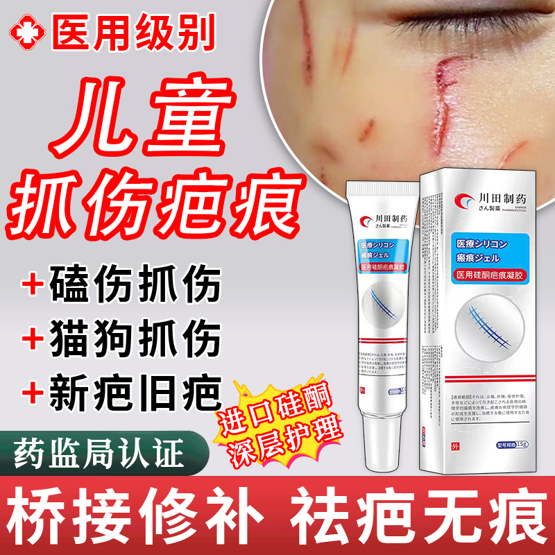 增生疤痕修复除疤膏 医用祛疤膏硅酮凝胶