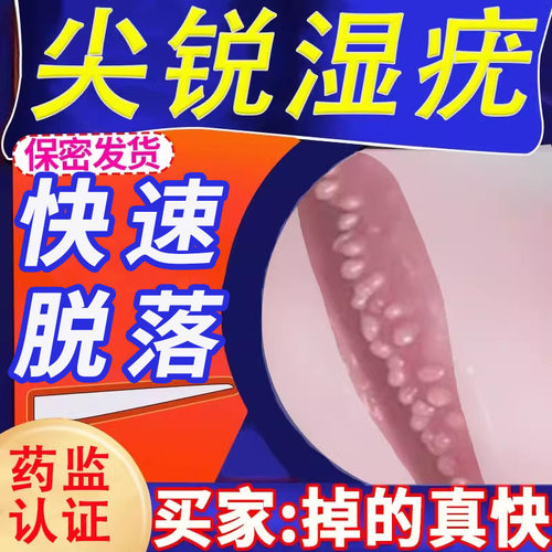 【日美技术】尖锐湿疣去除膏