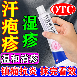 汗泡疹藥膏專用止癢膏去濕疹真菌根感染起手上起小水泡脫皮汗狀疹