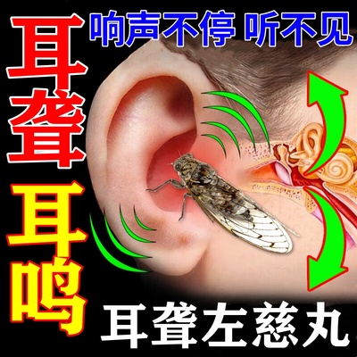 【太极】耳聋左慈丸(浓缩丸)0.375g*200丸/瓶