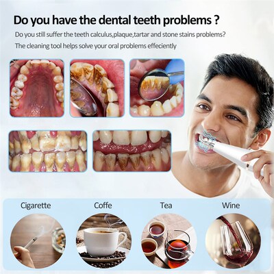 极速G6 Ultrasonic Dental Calculus ReFmover Teeth Plaque Scal