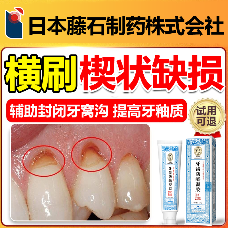 牙齿楔状缺损修补牙膏护龈固齿