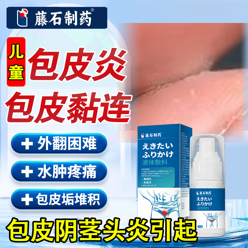 【药监局备案】儿童包皮黏连