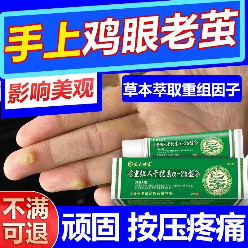 手指头上长鸡眼老茧脚上跖疣肉刺去除起茧肉刺硬疙瘩软化膏贴wg