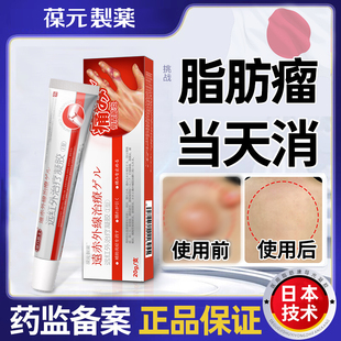 葆元制药皮下脂肪瘤消瘤膏特肿硬块皮肤纤维瘤去腺囊肿效蓖麻子康