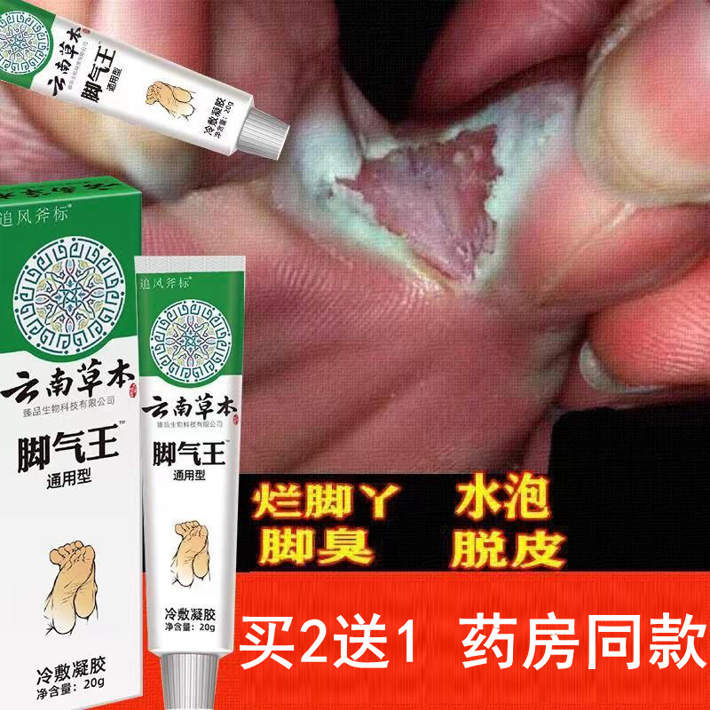 脚痒水泡脱皮烂脚丫脱皮糜烂烂脚上长水泡痒脚趾缝烂痒脚丫子痒