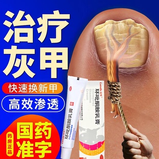 治疗灰指甲癣黑甲厚甲药真菌感染杀菌专用环吡酮胺乳膏正品效特药