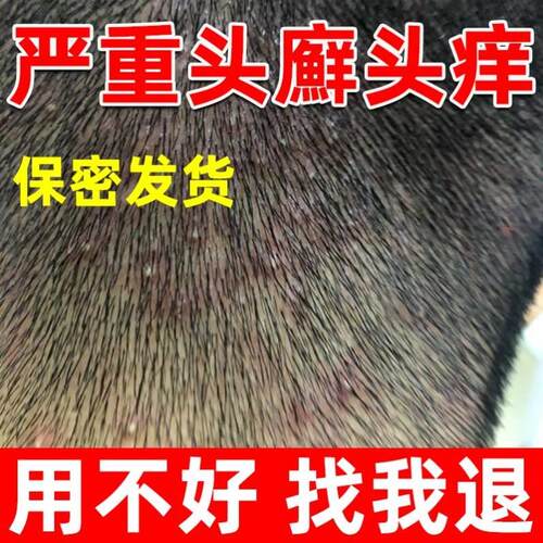极速云南本草藓霸百消膏苗王本草皮毒F清软膏苗疆奇痒灵云南本草