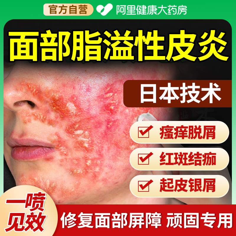 【阿里药房直售】面部脂溢性皮炎