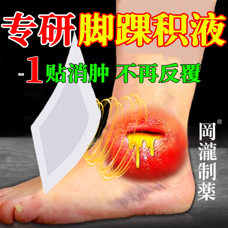 脚踝积液难消除关节疼痛滑膜炎专用膏贴积水肿崴韧带扭伤热敷消肿