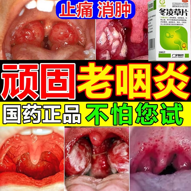 【王屋山】冬凌草片0.25g*100片*1瓶/盒