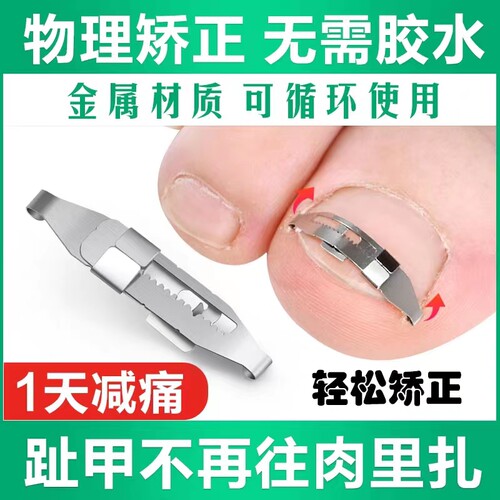 正甲扣正甲贴脚趾甲沟专用嵌甲矫正器贴片脚趾甲长肉里拉拉炎神器