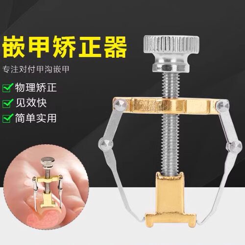 甲沟嵌甲矫正器炎趾甲长肉里