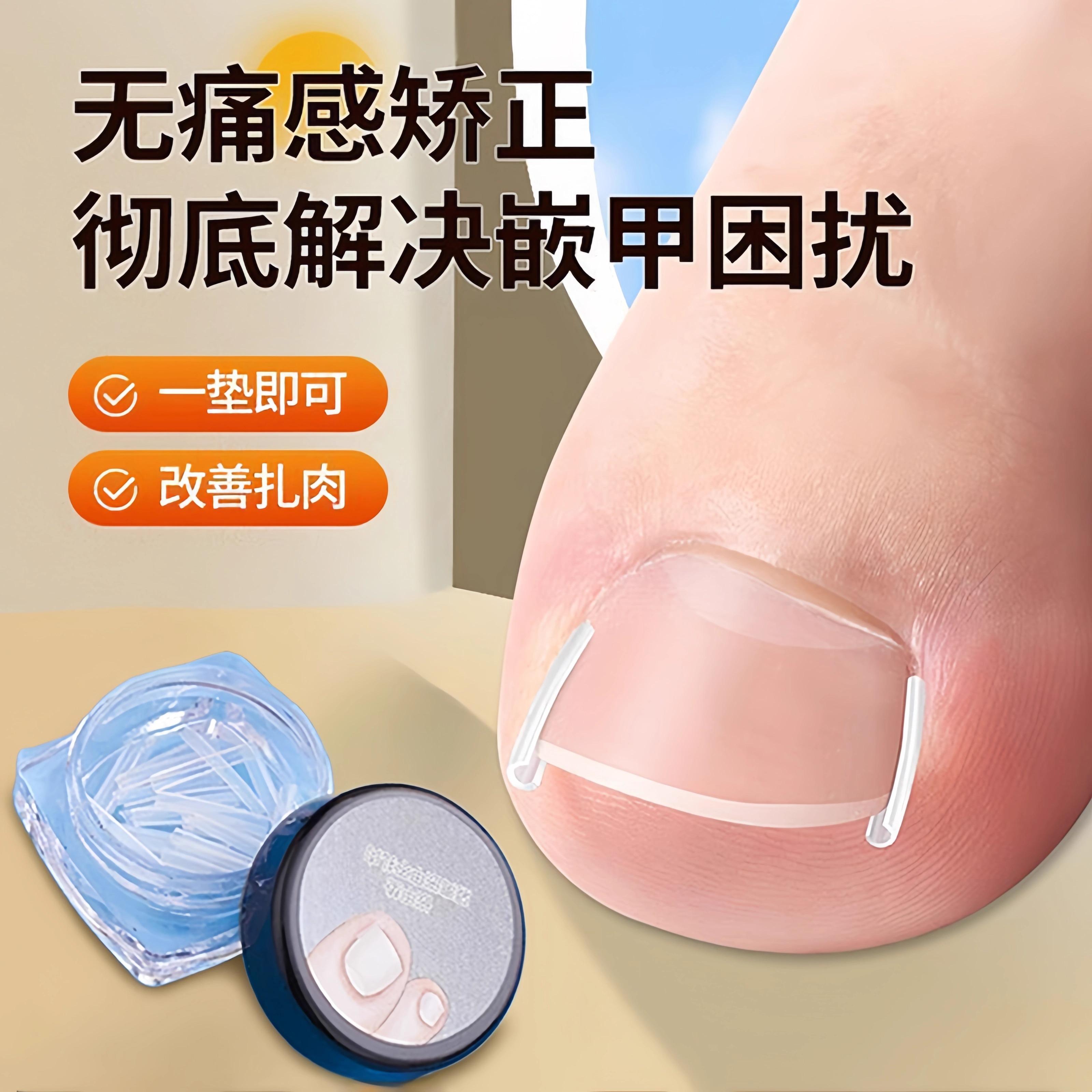 甲沟神器指甲矫正器隔离填充垫片