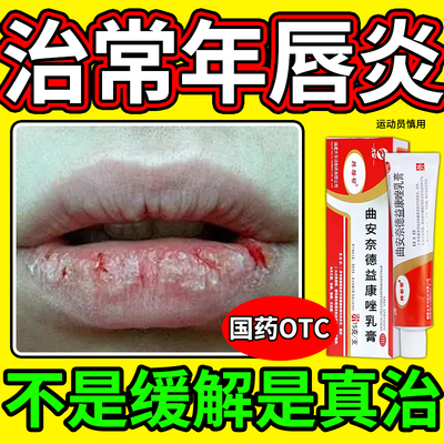 嘴唇防干裂脱皮唇炎药膏专用治口角炎儿童醋酸曲安奈德益康唑乳膏