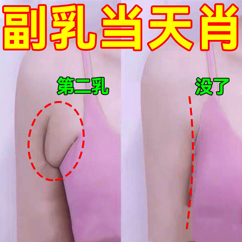 极速【当天d肖副乳】去副乳专用神器疏通腋下淋巴肿大颈部散结消