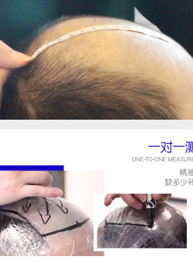 极速极客侠假发男帅气韩版无痕A发际线短发头顶男士生物头皮补发