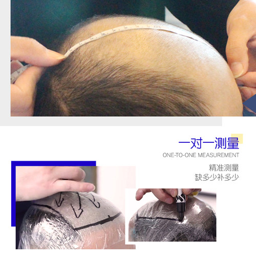 极速极客侠假发男帅气韩版无痕A发际线短发头顶男士生物头皮补发