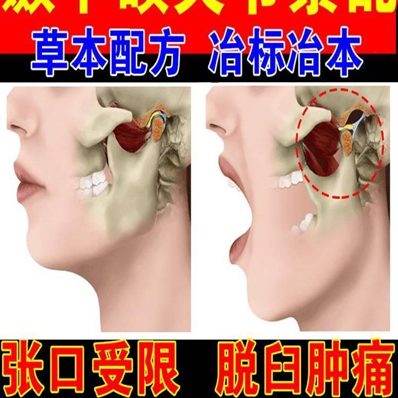 极速颞下颌关节紊乱热p敷下巴歪大小脸偏弹响牙齿矫正器理疗张口
