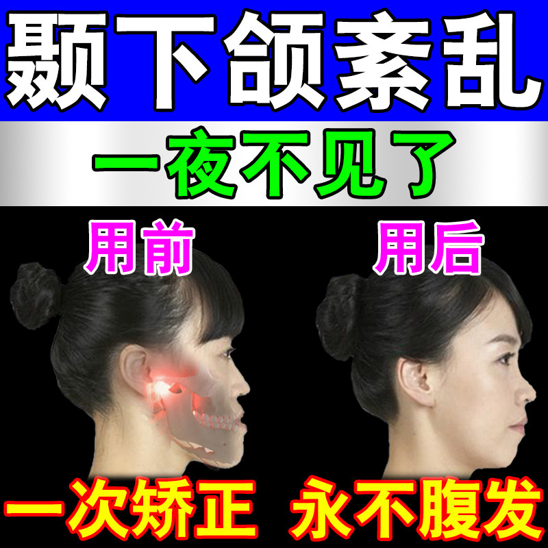 极速颞下颌关节紊乱热q敷改p善大小脸矫正神器防止下颚骨弹响下巴