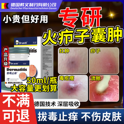 【德国技术】火疖子拔毒拔脓膏