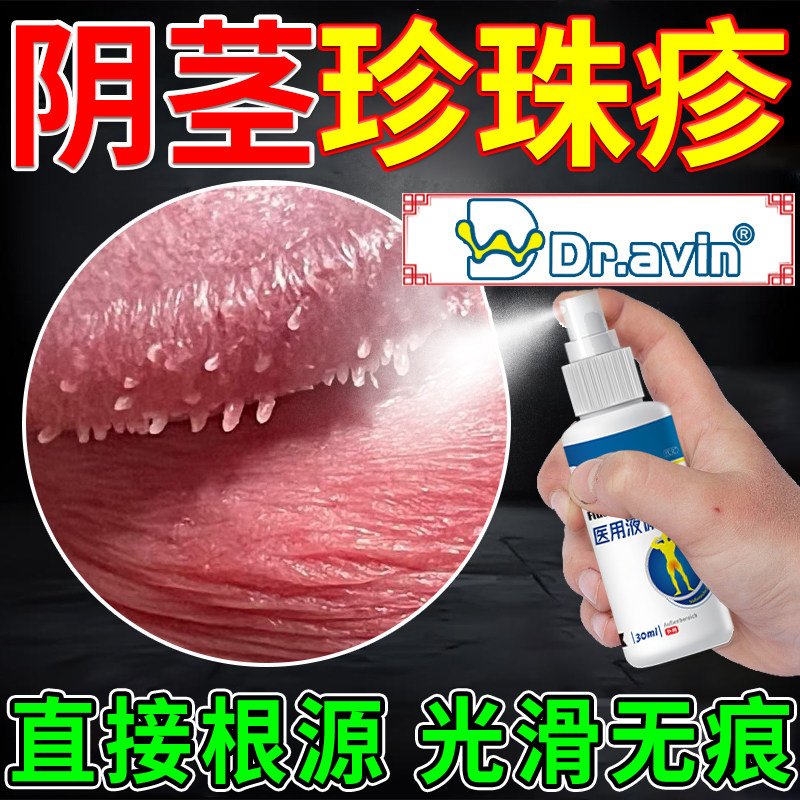男性珍珠丘疹专用龟头炎阴茎小疙瘩去除阴茎冠状沟珍珠粒疹喷剂AZ